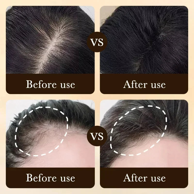 ZOZU Anti Hair Loss Regrowth Essence, Biotin Treatment, Thick Hair
