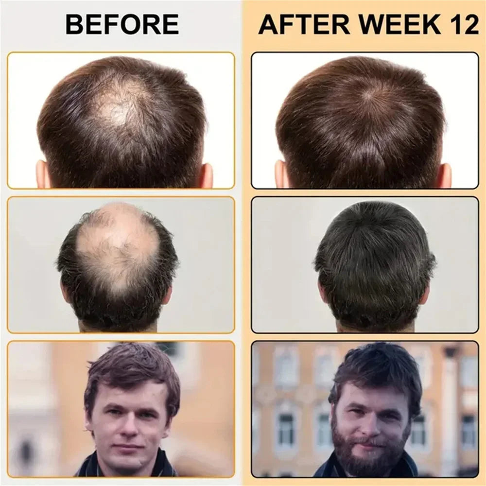 ZOZU Anti Hair Loss Regrowth Essence, Biotin Treatment, Thick Hair