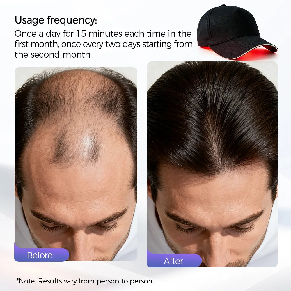 BLUE & RED Light Laser Therapy 3 in 1 Hair Cap 210 LED, Thick Hair