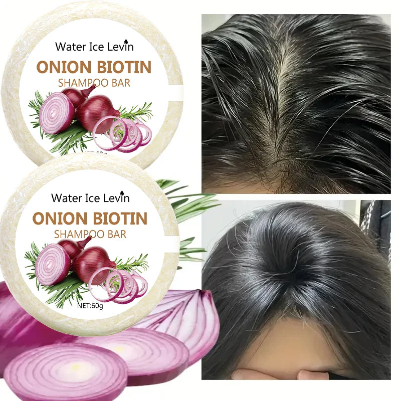 ONION BIOTIN Shampoo Bar, With Rosemary Extract
